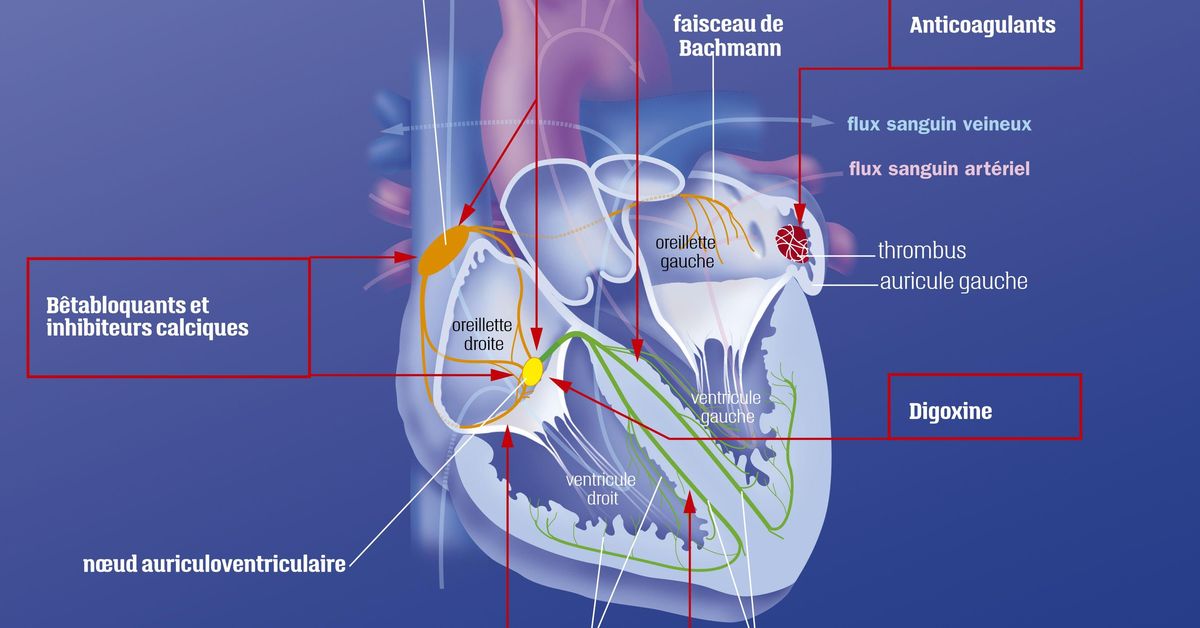 Fibrilation atriale